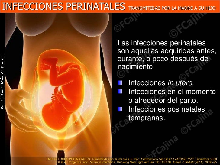 infecciones perinatales torch